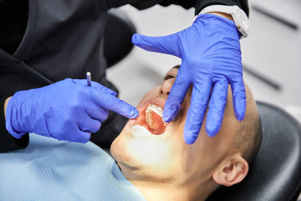Best Emergency Tooth Extraction in Elkin, NC